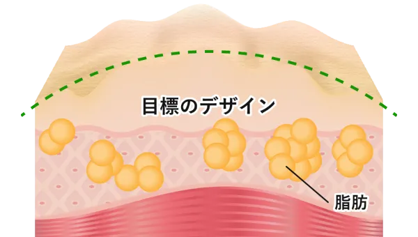 目標のデザイン 脂肪