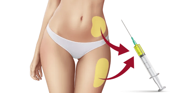 お腹や太ももから脂肪を採取