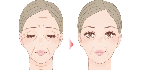 再生した後は緩やかに年齢に応じて戻っていく