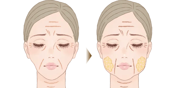 経過とともに余計なリスクを抱えることも⋯?