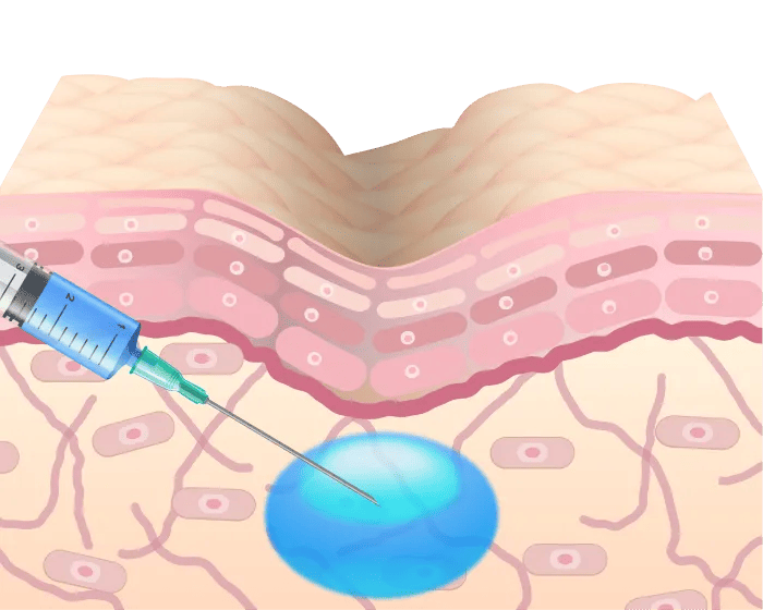 シワのある肌構造