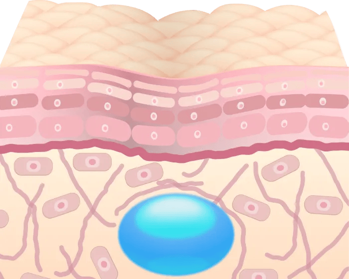 シワを押し上げた肌状態