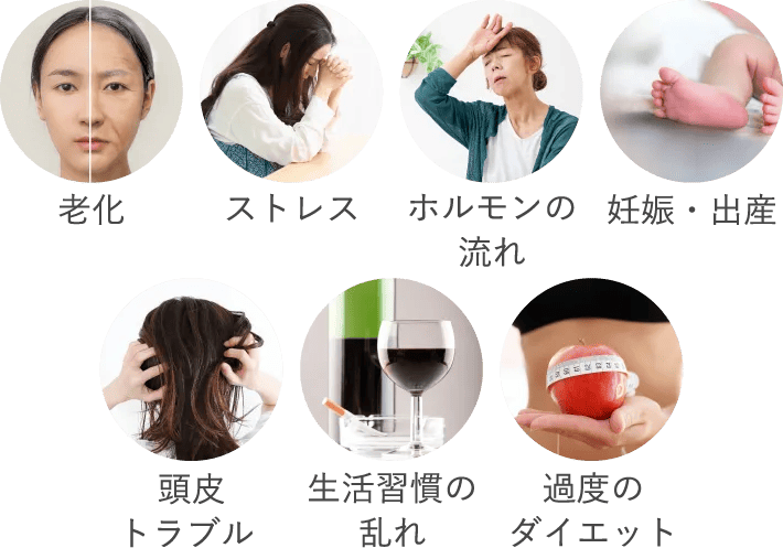 老化 ストレス ホルモンの流れ 妊娠・出産 頭皮トラブル 生活習慣の乱れ 過度のダイエット
