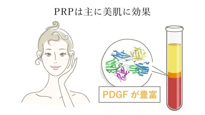 PRPは主に美肌に効果 PDGFが豊富