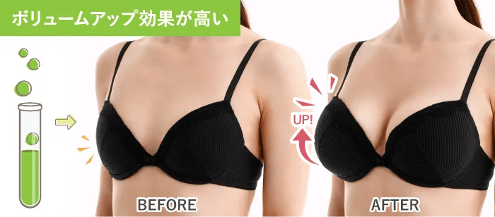ボリュームアップ効果が高い BEFORE AFTER UP!