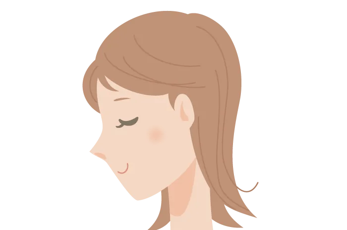 絶壁頭修正