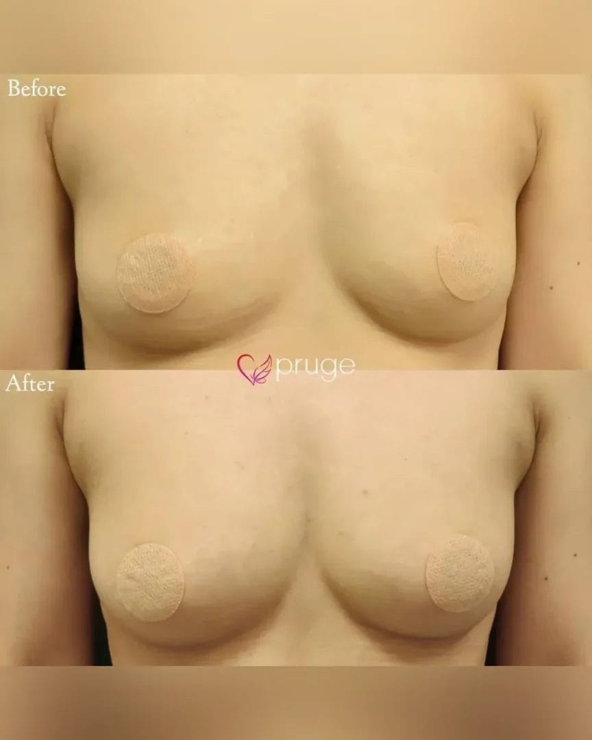 塩見 知大院長 代表症例6