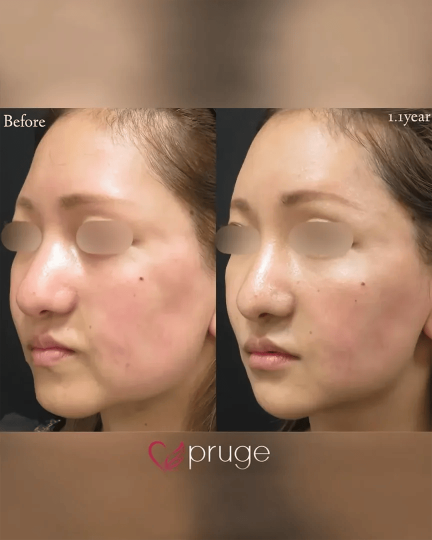 岡本 慎一理事長 代表症例5