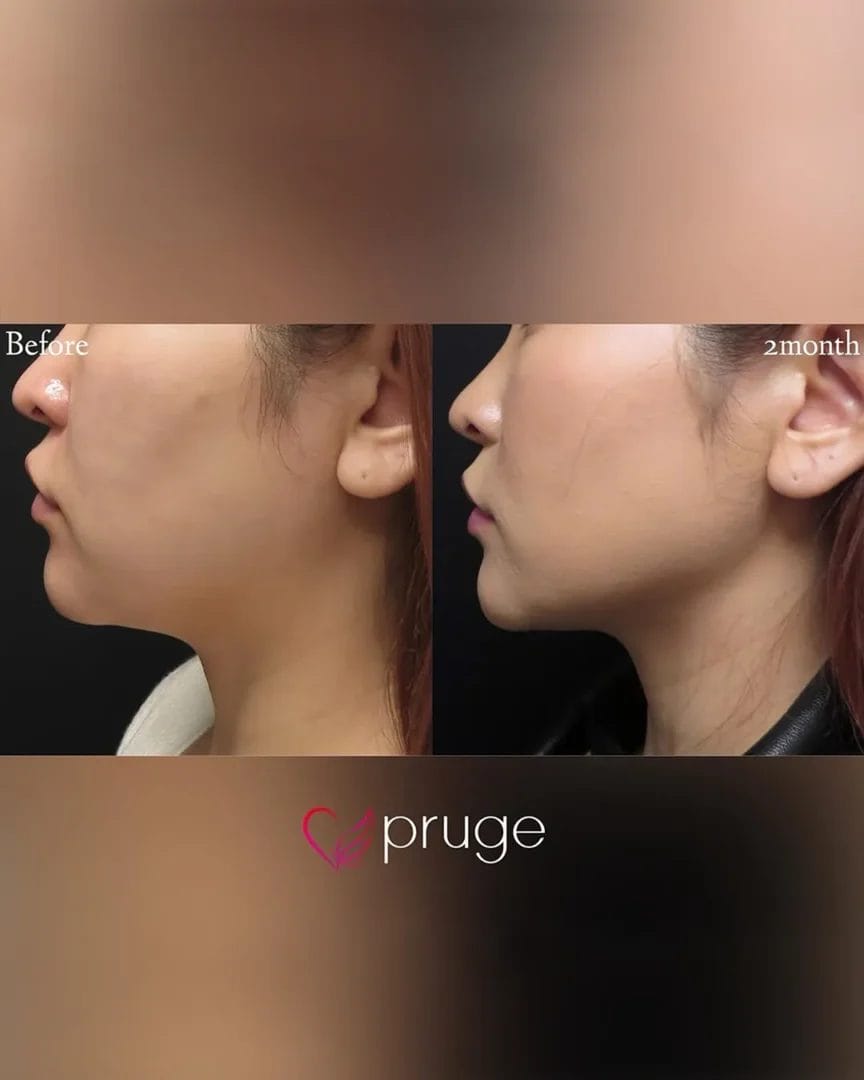 塩見 知大院長 代表症例4