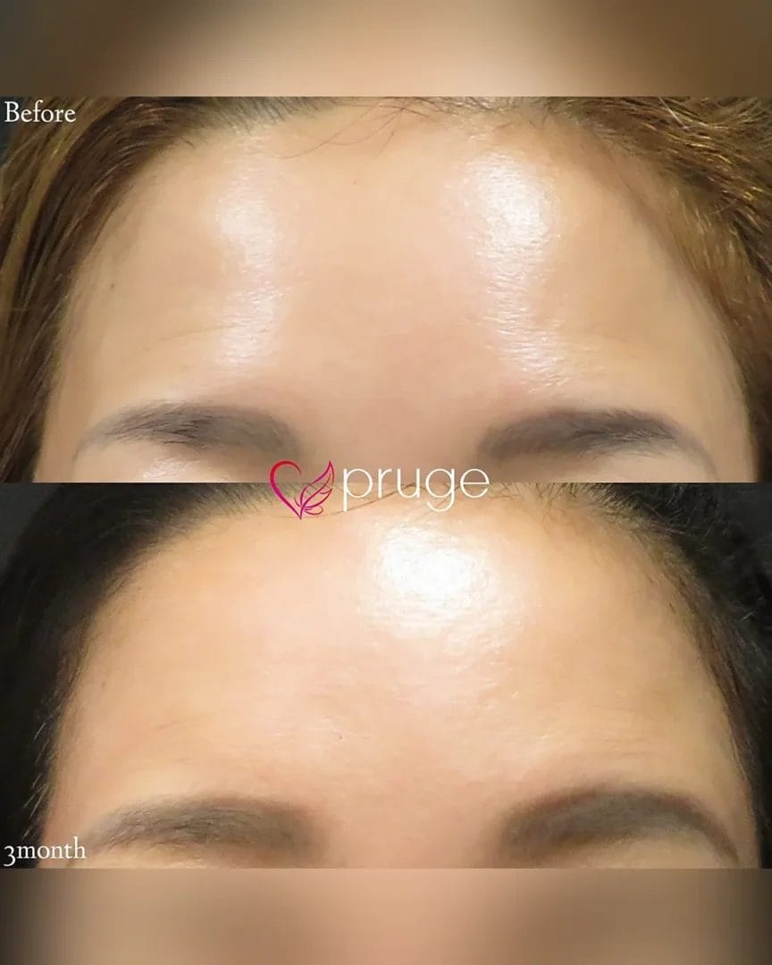 塩見 知大院長 代表症例3