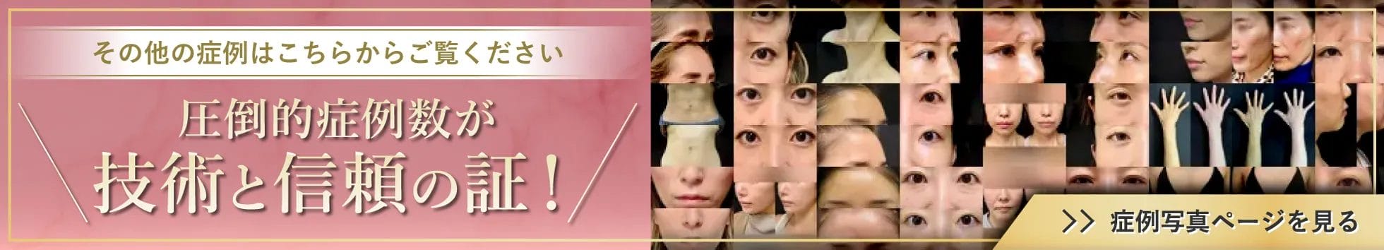 その他の症例はこちらからご覧ください　圧倒的症例数が技術と信頼の証！　症例写真ページを見る