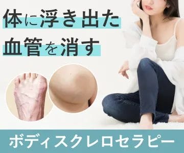 体に浮き出た血管を消す　ボディスクレロセラピー